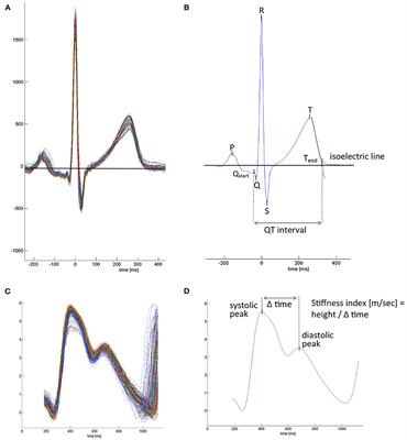 Nocturnal Heart Rate and Cardiac Repolarization in Lowlanders With Chronic Obstructive Pulmonary Disease at High Altitude: Data From a Randomized, Placebo-Controlled Trial of Nocturnal Oxygen Therapy